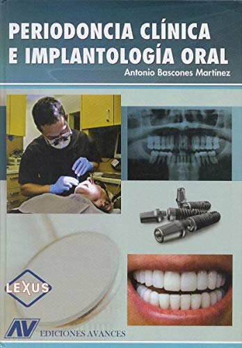 Periodoncia, Diagnostico Y Tratamiento De La Enfermedad (2ª Ed.)