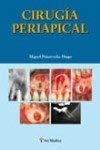 Cirugia Periapical